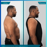 SlimForm™ – Faja de Compresión y Moldeado Masculino de Alta Tecnología